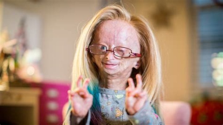 Learn About Adalia Rose: A Complete Guide To Her Incredible Journey