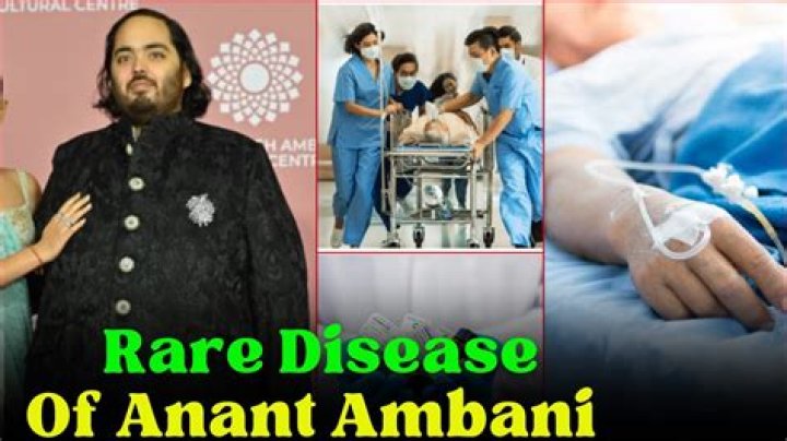 The Complete Guide To Ambani Disease: Symptoms, Causes, And Treatment