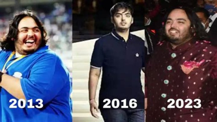 Anant Ambani's Battle With The Disorder: Insights And Impact