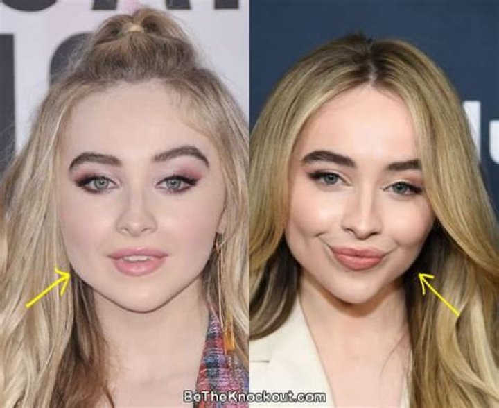The Complete Guide: Did Sabrina Carpenter Undergo Cosmetic Surgery?