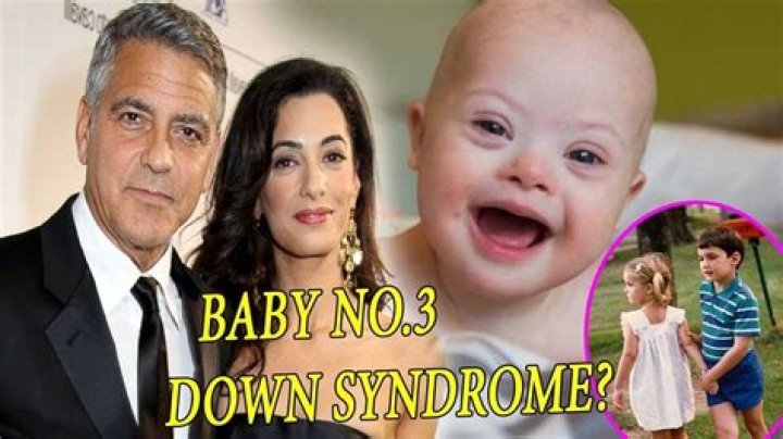A Journey With Down Syndrome
