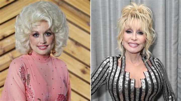 Search The Truth: Has Dolly Parton Undergone Cosmetic Enhancements?