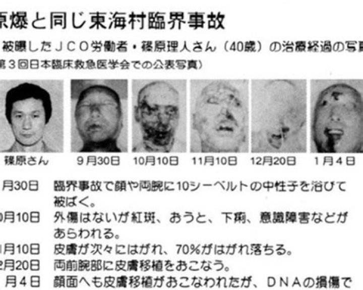 The Extraordinary Birth Of Hisashi Ouchi: A Life Marked By Unfathomable Suffering