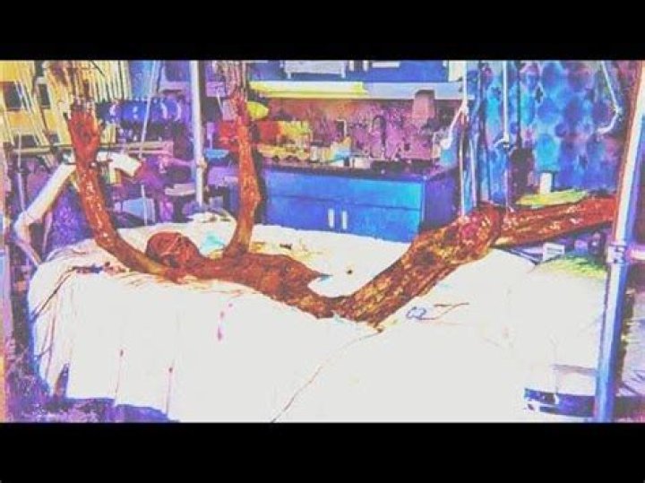 Devastating Consequences: The Full Story Of Hisashi Ouchi's Tragic Radiation Exposure