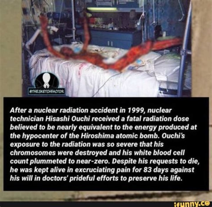 The Tragic Case Of Hisashi Ouchi: Radiation Burns And The Worst Industrial Accident