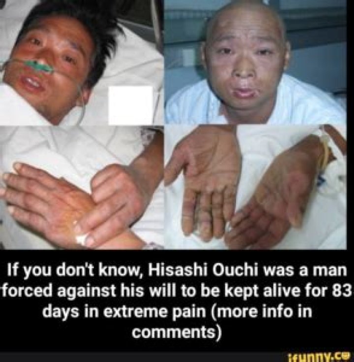 The Tragic Demise Of Hisashi Ouchi: How Did He Perish?