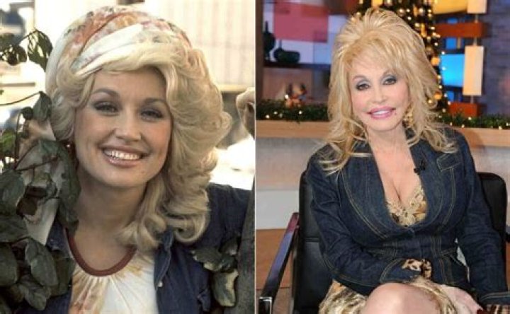 Dolly Parton's Comprehensive Guide To Plastic Surgery