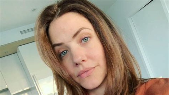 The Ultimate Guide To Julie Gonzalo's Facial Scar: History, Impact, And Treatment