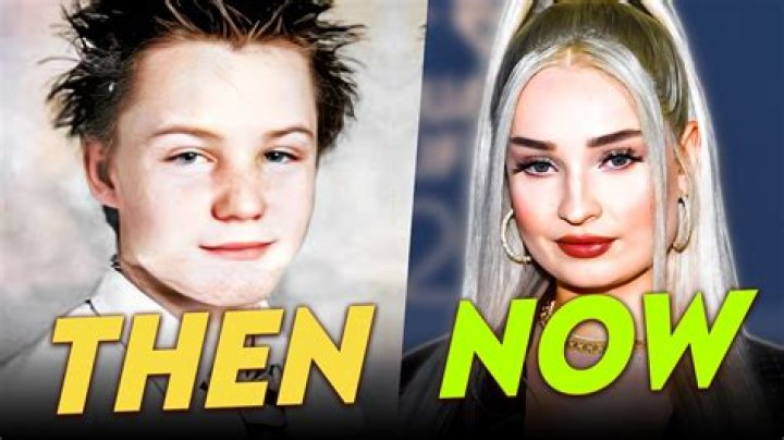 Kim Petras' Transformation: Before And After Her Transition Journey