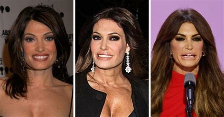 Kimberly Guilfoyle's Transformation: A Before And After Journey