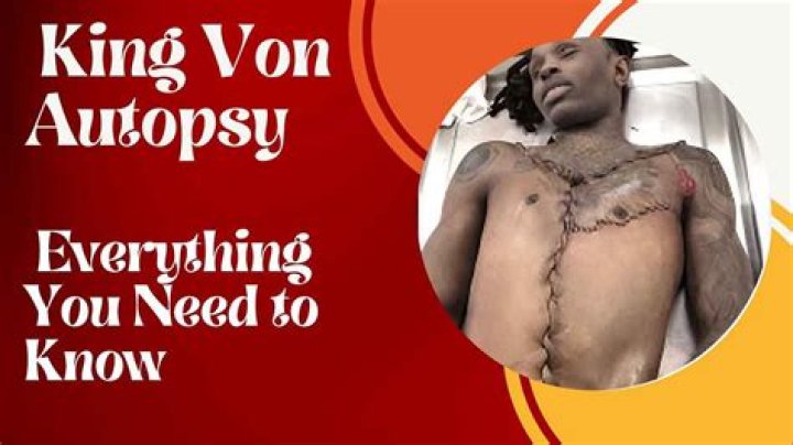 King Von Autopsy Report: An In-Depth Analysis Of The Late Rapper's Death