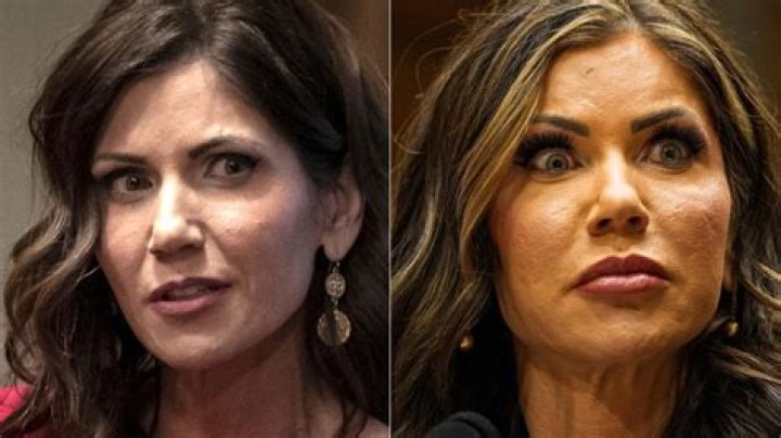 The Truth About Kristi Noem's Alleged Facelift Procedure