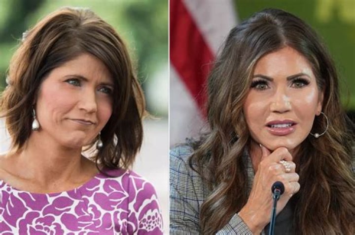 Has Kristi Noem Had Plastic Surgery? Rumors And Speculations