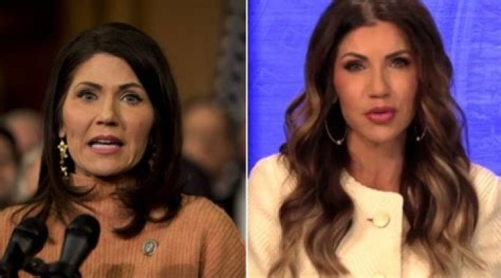 Profiling Kristi Noem's Plastic Surgery Enhancements