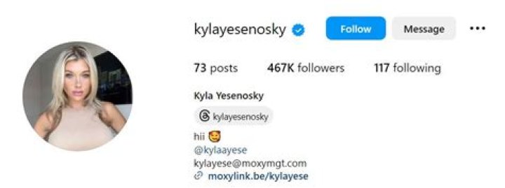 The Ultimate Guide To The Kylayesenosky Leak Scandal