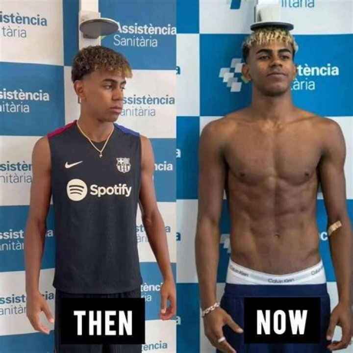 Discover The Astonishing Physique Transformation Of Lamine Yamal