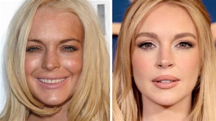 Unveiling Lindsay Lohan's Nose Journey: Insights And Transformations