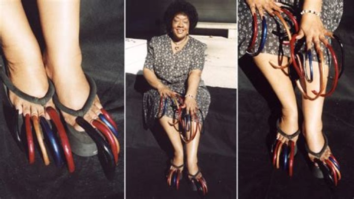 The Astonishing Story Of The World's Longest Toenails