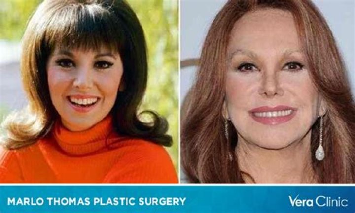 Marlo Thimas: The Truth About Her Plastic Surgery Revealed