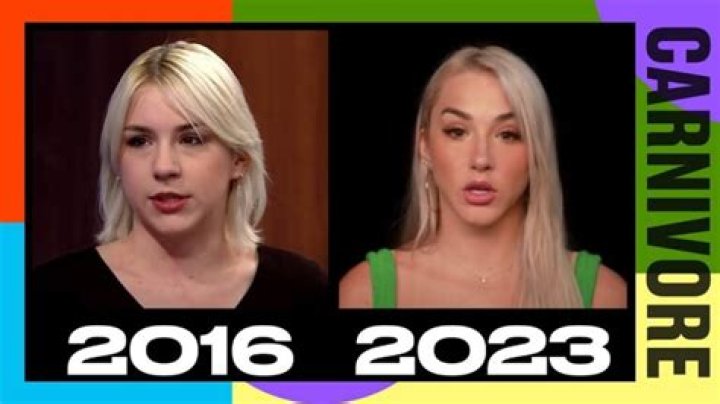 Unveiling Mikhaila Peterson's Plastic Surgery: Discoveries And Insights