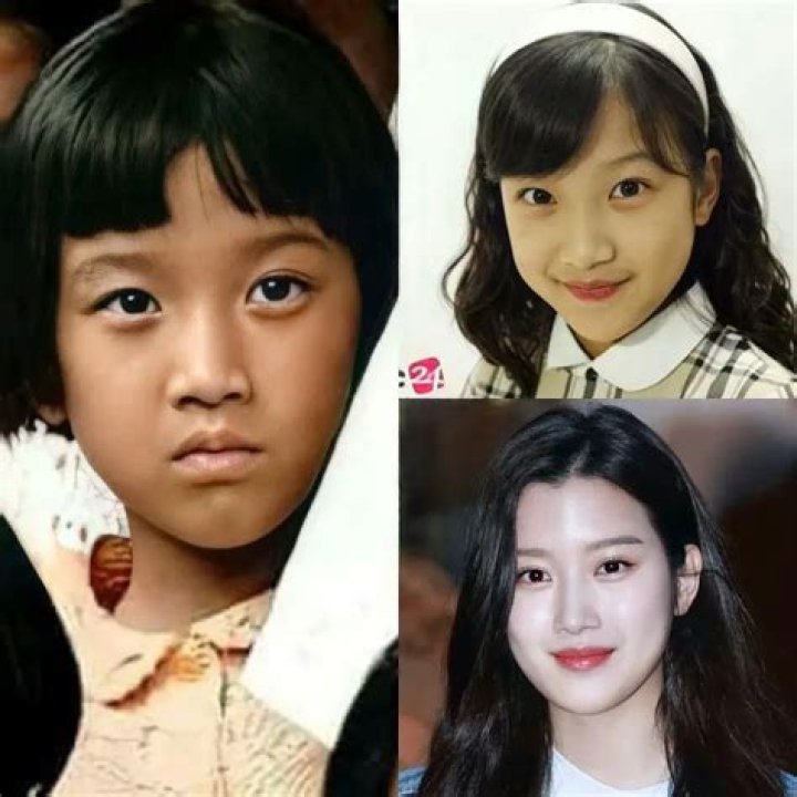 Moon Ga Young's Plastic Surgery: Before And After Analysis