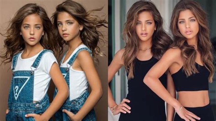 The Evolution Of Beauty: The Most Beautiful Twins In The World, Now Grown Up