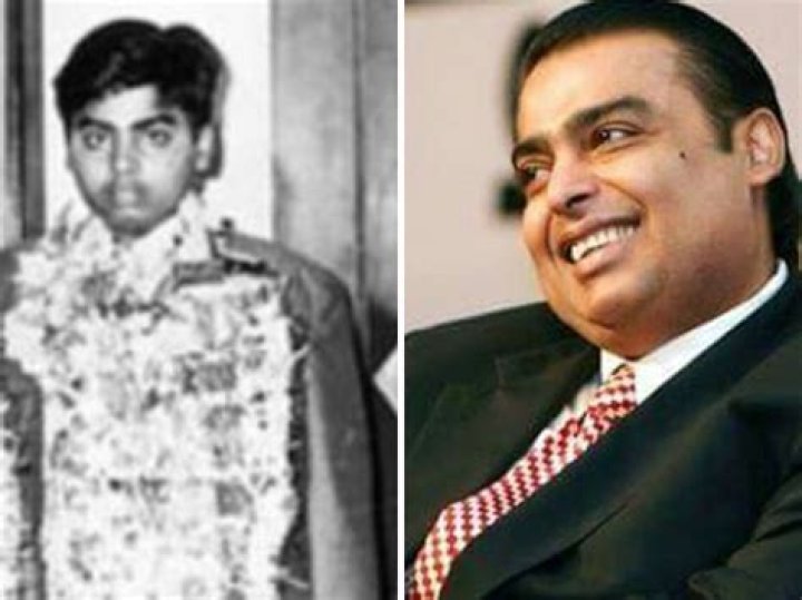 The Inside Scoop On Mukesh Ambani's Recent Surgery
