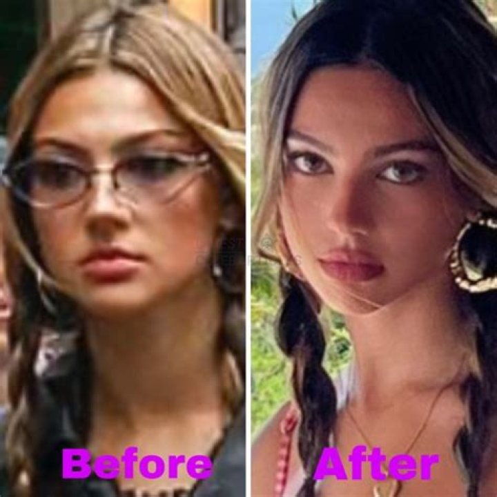 The Ultimate Guide To Understanding Nancy Deme And Its Impact