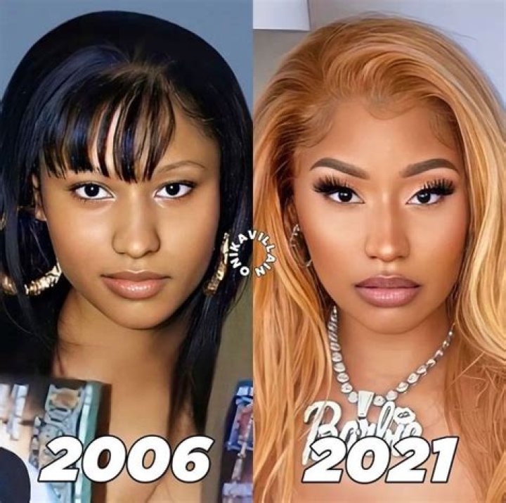 Skin Transformation: Nicki Minaj's Before And After Bleaching