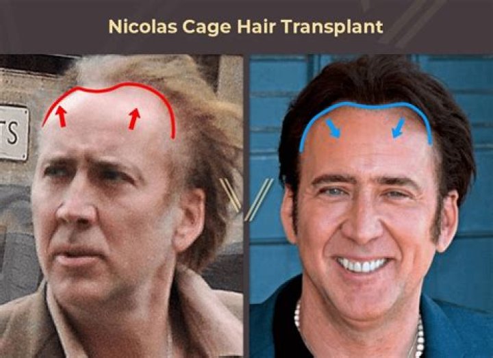Discover Nicolas Roman's Hair Transformation: A Stylish Revelation