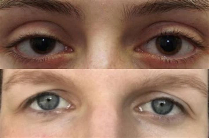 Enchanting Prey Eyes: Capturing The Allure Of Nature