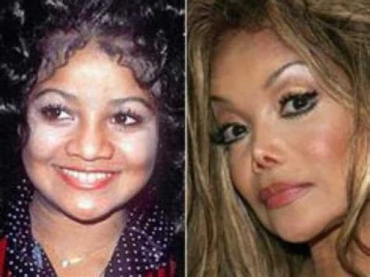 Unmasking The Hidden Truth: Celebrities Who Bleached Their Skin