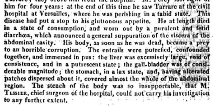 The Strange Autopsy Of Tarrare, The Man Who Could Eat Anything