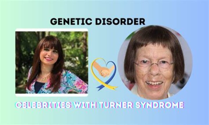 Celebrities With Turner Syndrome | Actresses With Turner Syndrome