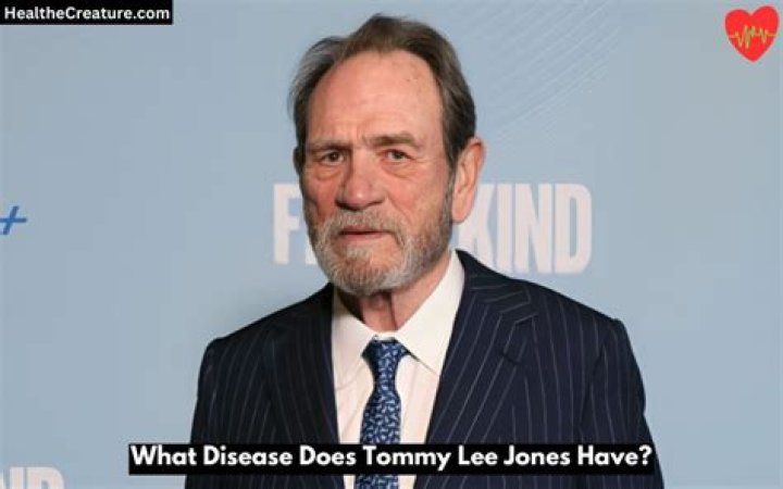 Unveiling Health Insights: What Ails Tommy Lee Jones?