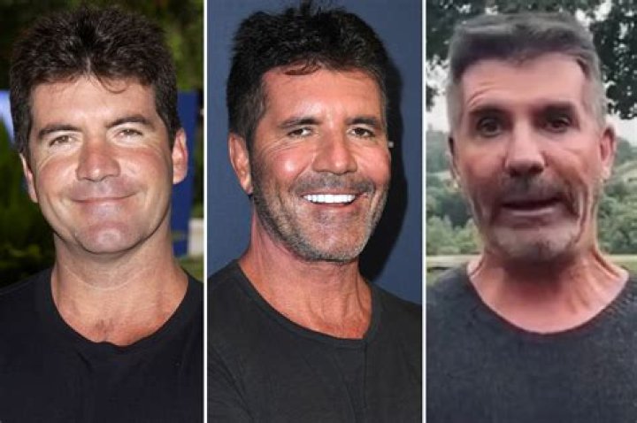 Is Simon Cowell's Son Seriously Ill? Uncovering The Health Concerns